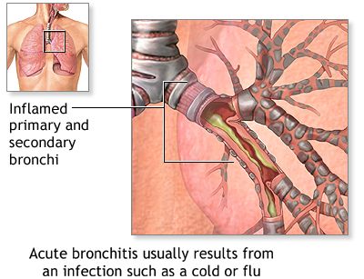 infectious bronchitis virus genotype