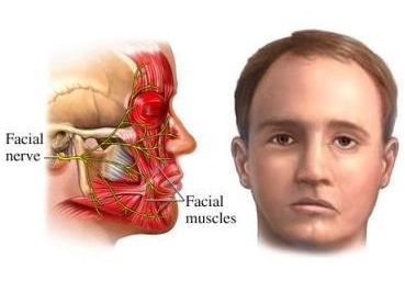 Causes of various consistent facial twitches