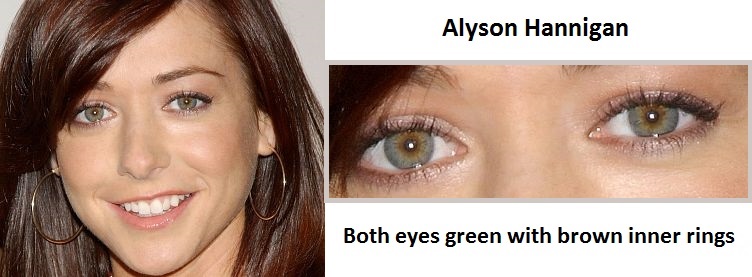 alyson-hannigan-central-heterochromia-3