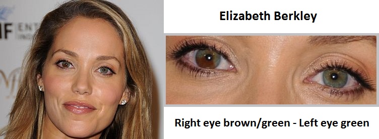 elizabeth-berkley-sectoral-heterochromia-3