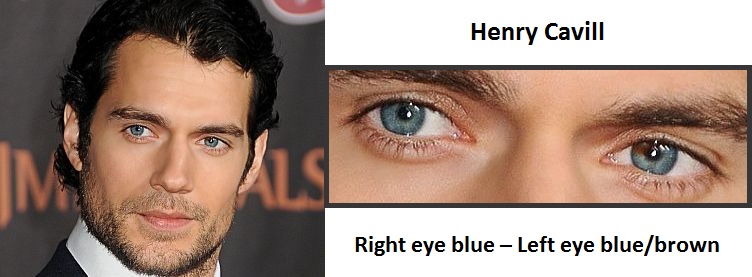 henry-cavill-sectoral-heterochromial-3