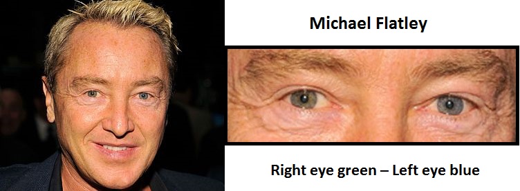 michael-flatley-complete-heterochromia-3